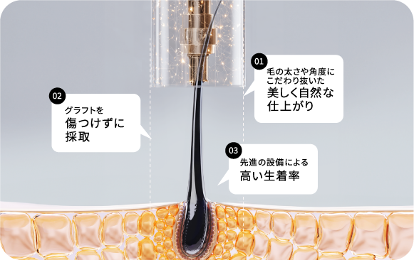 HAIR OF TOKYO のデザイン植毛は