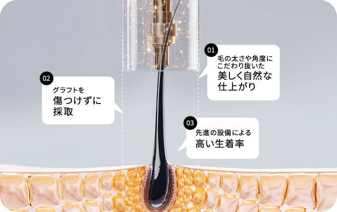 HAIR OF TOKYO のデザイン植毛は